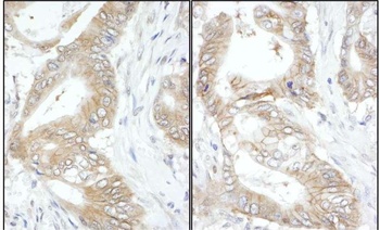 USP14 Antibody