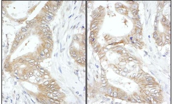 Rabbit anti-USP14 Antibody