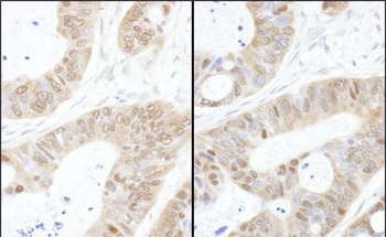 Rabbit anti-USP14 Antibody