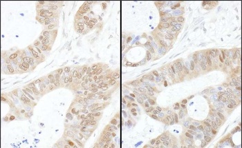 USP14 Antibody