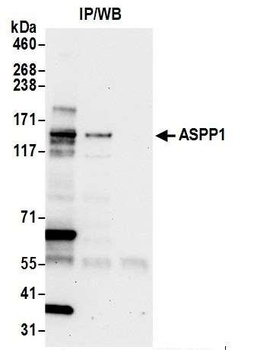 Rabbit anti-ASPP1 Antibody