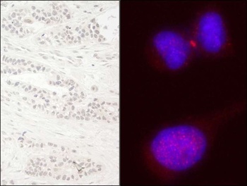 Rabbit anti-KIF14 Antibody
