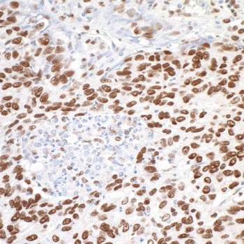 Rabbit anti-MTA1 Antibody