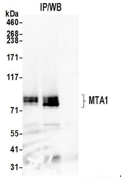 Rabbit anti-MTA1 Antibody