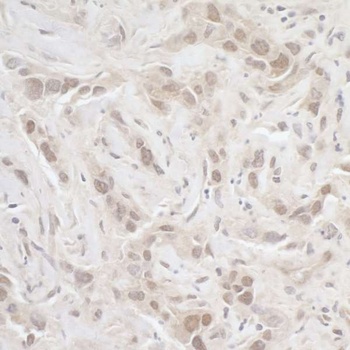 Rabbit anti-PPP3CA Antibody