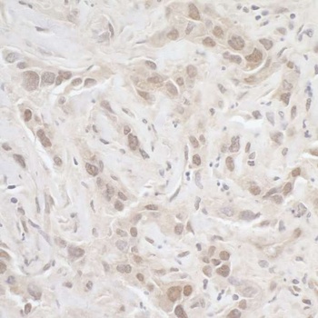 PPP3CA Antibody