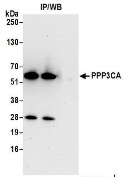 Rabbit anti-PPP3CA Antibody
