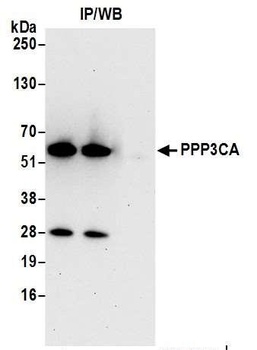 PPP3CA Antibody