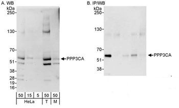 PPP3CA Antibody