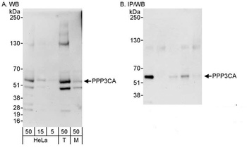 Rabbit anti-PPP3CA Antibody