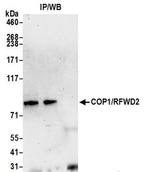 COP1/RFWD2 Antibody