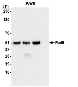 Rabbit Rad9 Antibody
