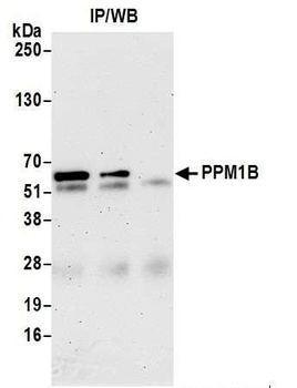 PPM1B Antibody
