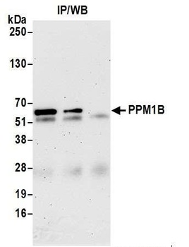 Rabbit anti-PPM1B Antibody