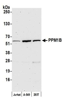 Rabbit anti-PPM1B Antibody