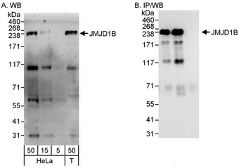 Rabbit anti-JMJD1B Antibody