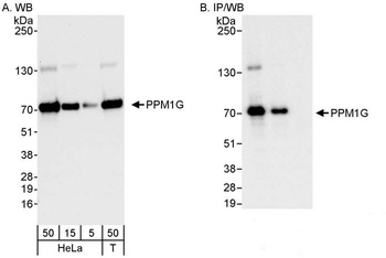 Rabbit anti-PPM1G Antibody