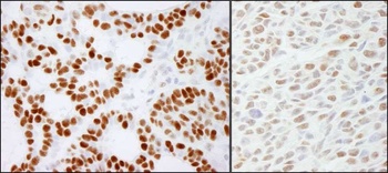 Rabbit anti-RCC2 Antibody