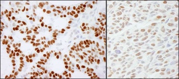 RCC2 Antibody