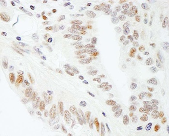 Rabbit anti-SUPT5H Antibody