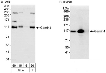Gemin4 Antibody