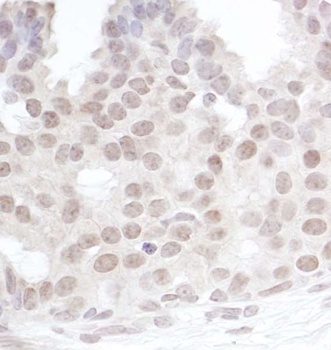 Rabbit anti-Gemin4 Antibody