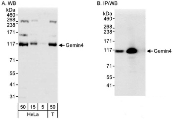 Rabbit anti-Gemin4 Antibody