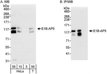 E1B-AP5 Antibody