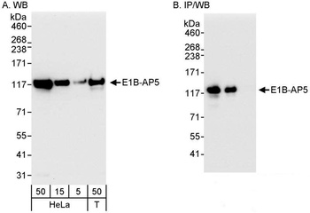 Rabbit anti-E1B-AP5 Antibody