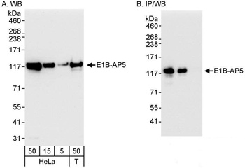 E1B-AP5 Antibody