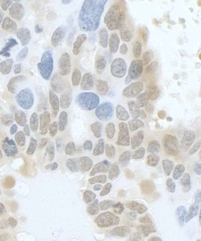 Rabbit anti-HURP/DLG7 Antibody