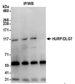Rabbit anti-HURP/DLG7 Antibody