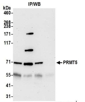 Rabbit PRMT5 Antibody