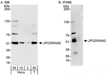 Rabbit JPO2/RAM2 Antibody