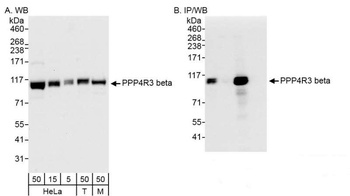 PPP4R3 Beta Antibody
