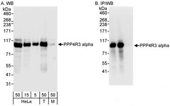 PPP4R3 Alpha Antibody