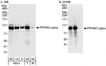 Rabbit anti-PPP4R3 Alpha Antibody