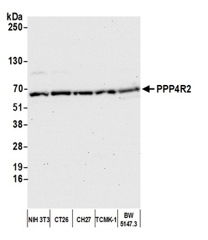 PPP4R2 Antibody