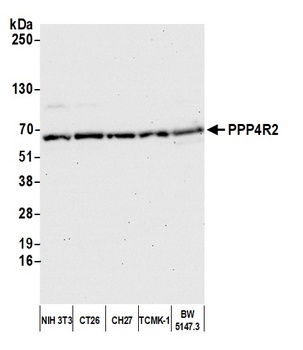 Rabbit anti-PPP4R2 Antibody