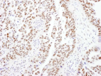 PPP4R2 Antibody