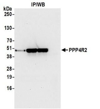 Rabbit anti-PPP4R2 Antibody