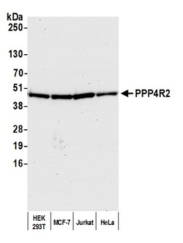 Rabbit anti-PPP4R2 Antibody