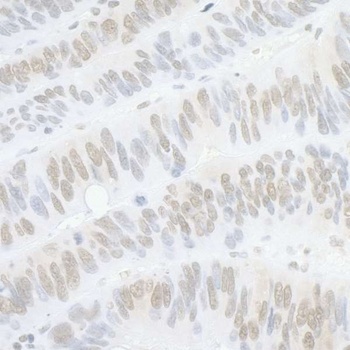 Rabbit anti-PPP4C Antibody