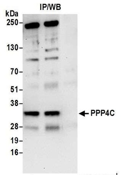 Rabbit anti-PPP4C Antibody