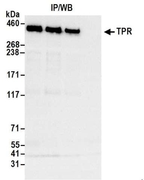 TPR Antibody