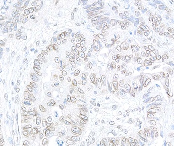Rabbit anti-TPR Antibody