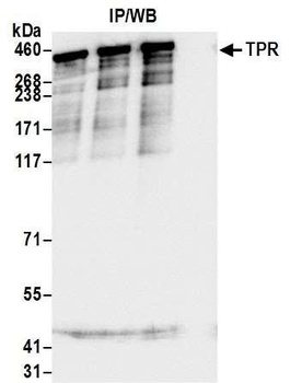 Rabbit anti-TPR Antibody