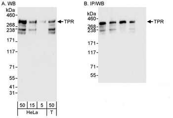 Rabbit TPR Antibody