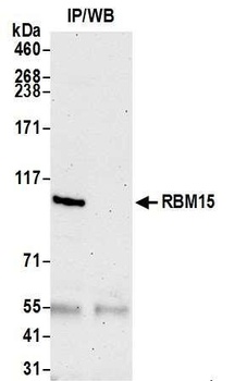 Rabbit anti-RBM15 Antibody