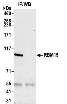 RBM15 Antibody